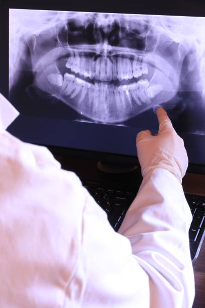 Best Knocked-Out Tooth (Avulsed Tooth) Treatment in Allison, IA