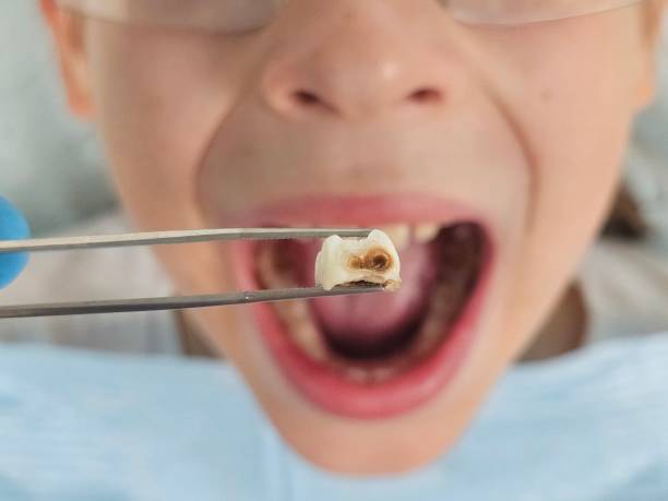 Best Emergency Pediatric Dental Care in Allison, IA